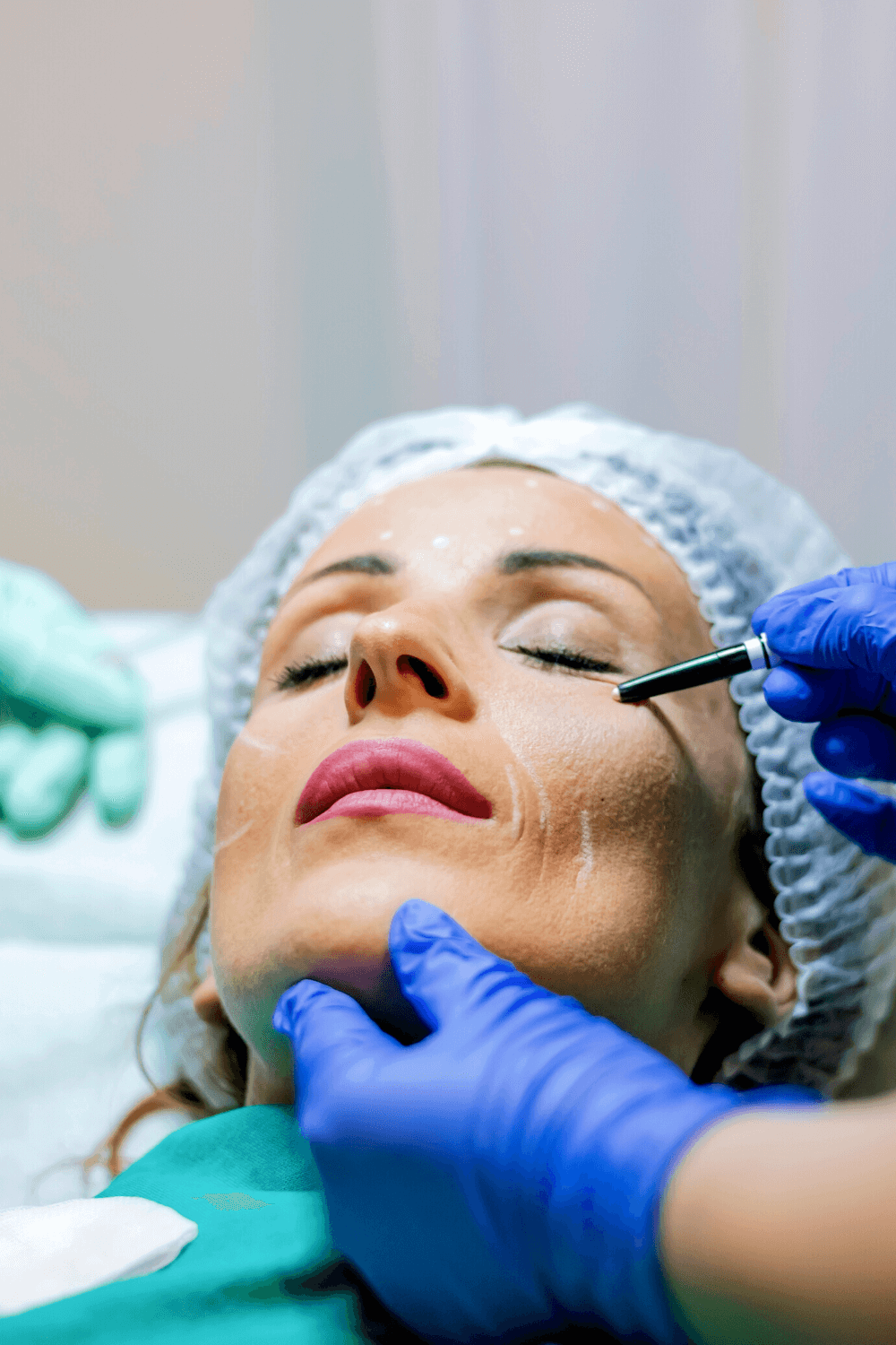 “Why I Got a Facelift”: Erin’s Facelift Journey Part 1