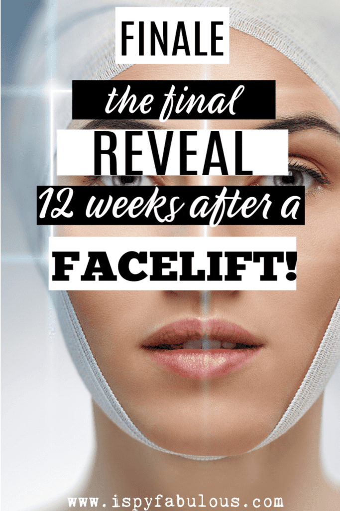 facelift before and after