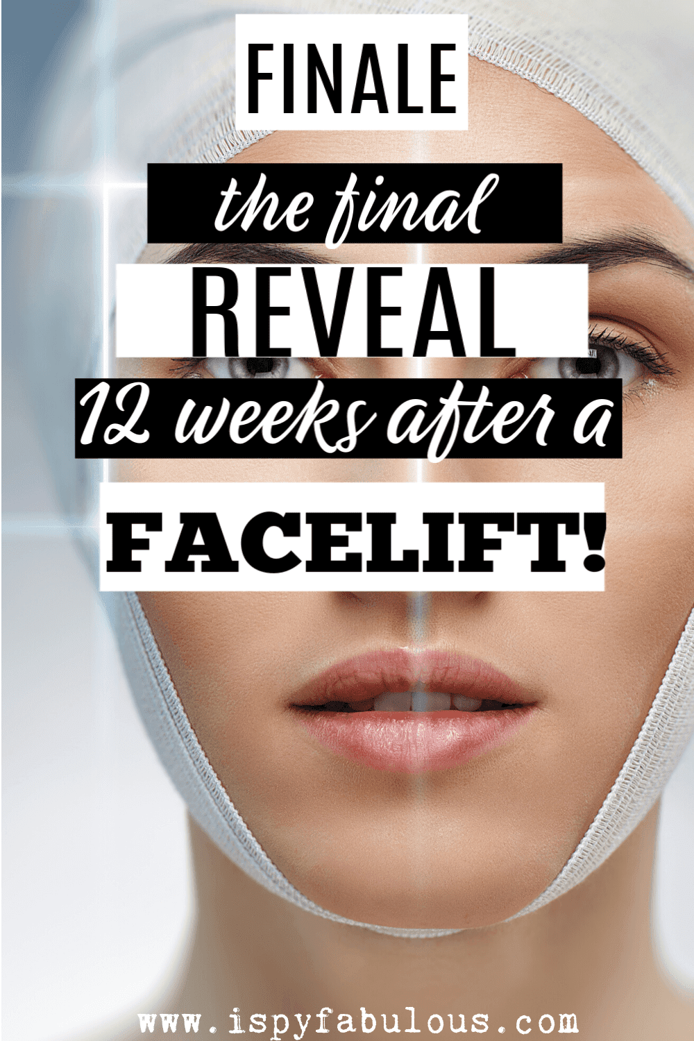 Erin’s Facelift Finale: Before and After Pictures 12-Weeks Post Surgery!