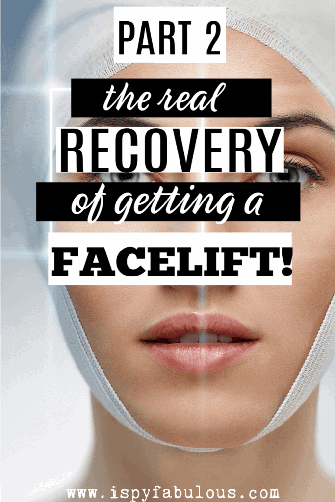 facelift recovery