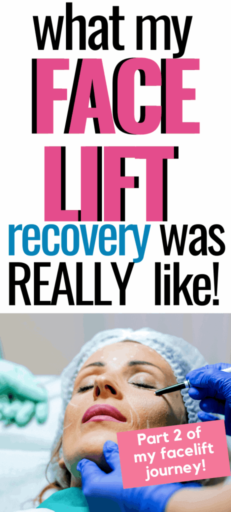 facelift recovery