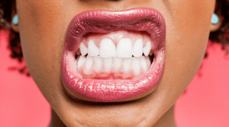 8 Tips To Improve Oral Health from Dry Mouth or Sjogren’s!