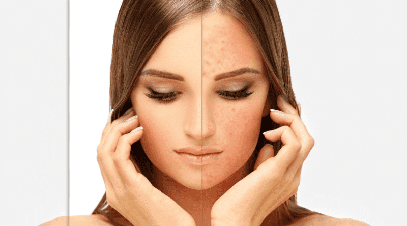 10 Skin Care Products For Reducing Redness and Skin Inflammation